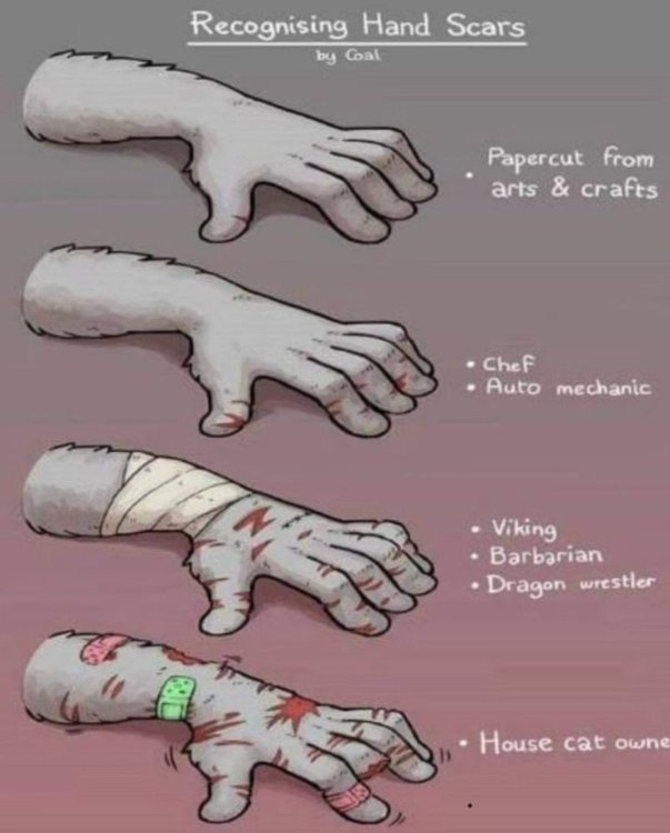 meme hand scars.jpg
